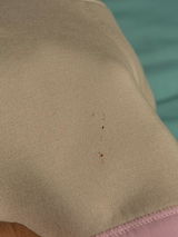 Anonymous review photo