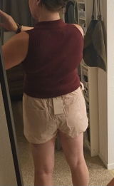 Anonymous review photo