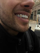 Brandonscarr review photo