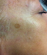 Hannelore N review photo