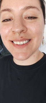 Anonymous review photo