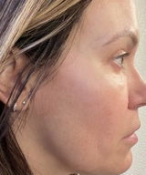 Step 2 | Treat: Brighten & Tighten VITAMIN C SERUM