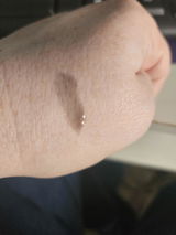 Lozza review photo