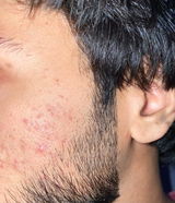 Talha review photo