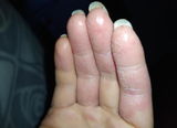 Kit para dermatitis y resequedad corporal