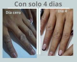 Kit para dermatitis y resequedad corporal