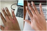 Kit para dermatitis y resequedad corporal