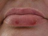 Revive Lip Balm