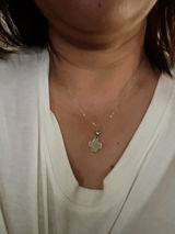 Anonymous review photo