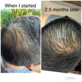 Hair Fall Control Solution Kit