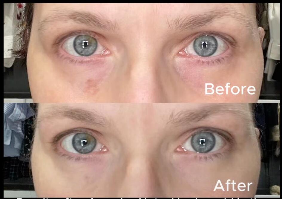 Bakuchiol + Niacinamide Anti-Aging Cream