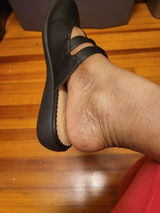 Anonymous review photo