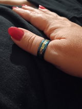 Anonyme review photo