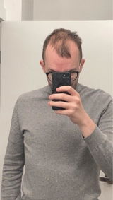 Milo review photo