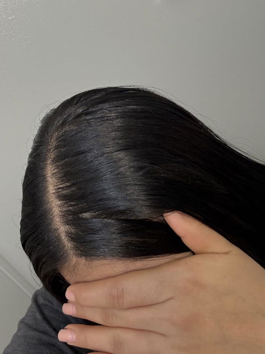 RootStim customer photo