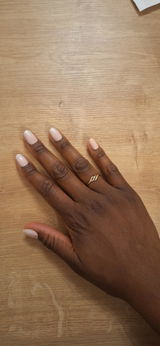 Anonyme review photo