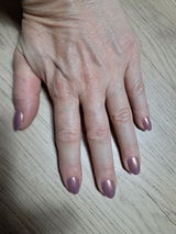 Celjac review photo