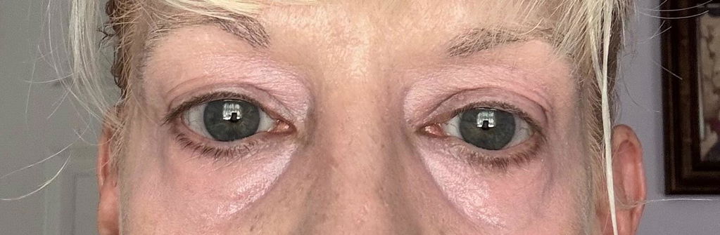 Customer review photo from Joycemnp
