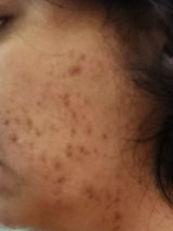 Anonymous review photo