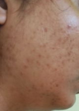 Anonymous review photo