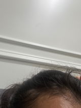Anika review photo