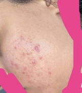 Cc review photo