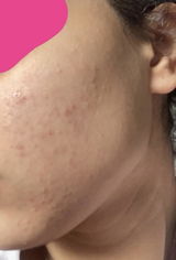 Cc review photo