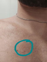 anônimo review photo