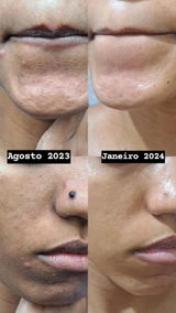 anônimo review photo