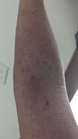 Anonymous review photo