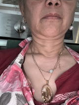 Anonymous review photo