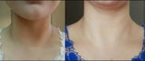 Akansha review photo