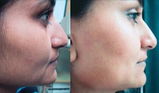 Meera Reddy review photo
