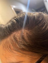 Anonyme review photo