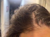 Anonyme review photo