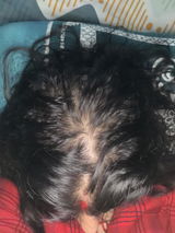 Anonymous review photo