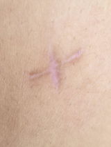 Anonymous review photo