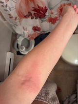 Anonymous review photo