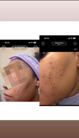 Anonyme review photo