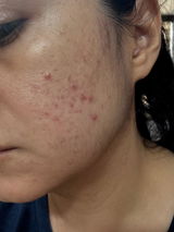 Elizabeth Heredia review photo