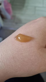 Anonymous review photo