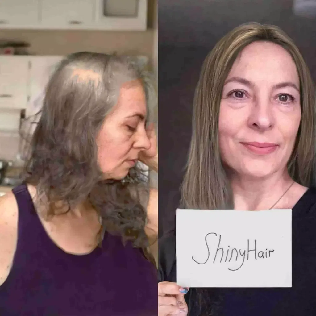 ShinyHair Haarwuchsbooster