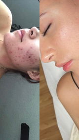 Alejandra review photo