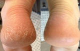 Piera review photo