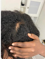 Anonyme review photo