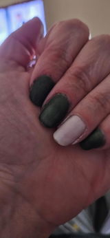 Anonymous review photo