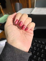Anonymous review photo