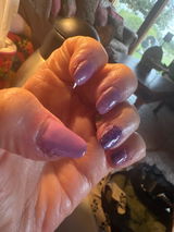 Anonymous review photo