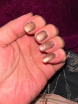 Anonymous review photo