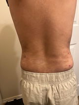 Anonymous review photo